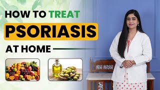 How to Treat Psoriasis at Home  Tips for Fast Psoriasis Recovery  Dr Health [upl. by Idarb]