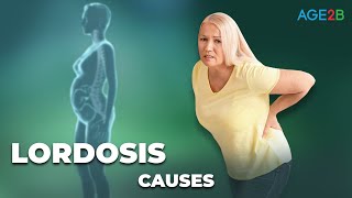 Causes of Lordosis  Why is my Back so Arched  Restore Your Neck Posture amp Curve [upl. by Akired]