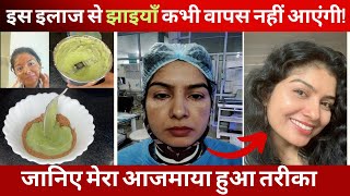 आयुर्वेदिक इलाज स्किन की 7 परतों के नीचे से झाइयाँ ठीक करने का मेरा सीक्रेट  MY SKINCARE ROUTINE [upl. by Iddo]