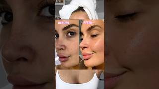 my skin beforeafter korean skincare routine 😱😍 coxir skincare skincaretips asmr [upl. by Ytoc432]