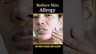 Foods reduce skin allergy  skin care skincare [upl. by Patrizio]