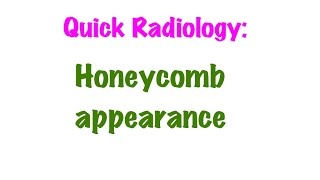 QUICK RADIOLOGY Honeycomb appearance on x ray [upl. by Neeluj]