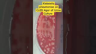 Klebsiella pneumoniae colony morphology on CLED of Urine Culture [upl. by Nitsuj]