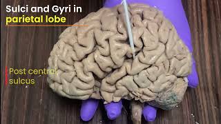 Brain Part 4 Sulci and Gyri in superolateral surface of brain [upl. by Nij]