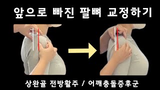 라운드숄더 ❌ 상완골 전방활주⭕️ 바이올리니스트 어깨통증 뚝딱 잡아드렸습니다 ‼️ 어깨충돌증후군 있을 땐 항상 이걸 조심하세요 [upl. by Repsihw]