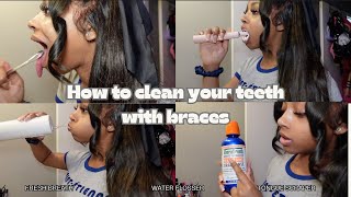 HOW TO CLEAN YOUR TEETH WITH BRACES  My Routine 😬✨ [upl. by Annayr]