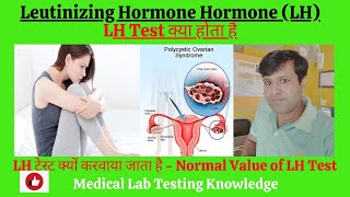 Luteinizing Hormone LH in Hindi  What is Luteinizing Hormone Test in Hindi  Normal Level of LH [upl. by Schofield]