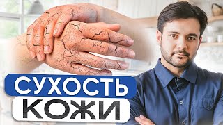 Вы забудете про СУХОСТЬ кожи и трещины Как избавиться от сухости кожи рук навсегда [upl. by Atiuqahc]