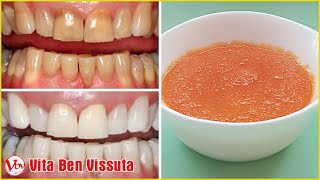 Come sbiancare i denti naturalmente – Rimuovere il tartaro a casa in 3 minuti [upl. by Ellita979]