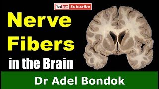 Commissural Association and Projection Fibers in the Brain Dr Adel Bondok [upl. by Jocko649]