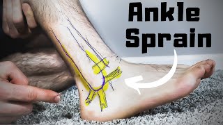 Twisted or Rolled Ankle Sprain Treatment FASTER Home Recovery Time [upl. by Hashimoto20]