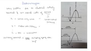 Electroretinogram [upl. by Eisned]