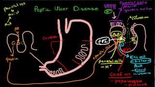 Peptic Ulcer Disease Pathophysiology [upl. by Taub]