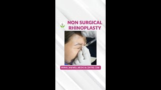 NonSurgical Rhinoplasty How Its Done  Nose Filler How It Works  Nose Job The Process [upl. by Ecissej]