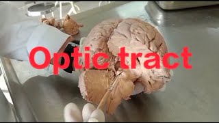 Neuroanatomy Optic pathway anatomy of optic pathway [upl. by Beverley]