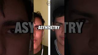 How to fix Facial Asymmetry🫣 [upl. by Doraj]