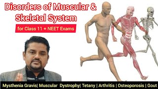 Disorders of Muscular and Skeletal System  Class 11 NCERT NEET Exams  Pashupati Sir [upl. by Javler]