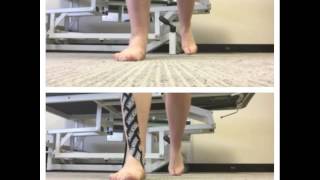 Kinesiology Rocktape to correct over pronation [upl. by Annoved]