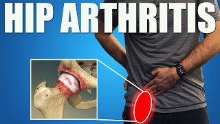 HIP OSTEOARTHRITIS BEST Exercises Stretches amp Advice for Hip amp Groin Pain Relief [upl. by Smith]