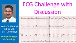 ECG Challenge with Discussion [upl. by Ayanal]