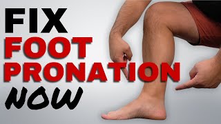 Correct Foot Pronation with these 5 Essential Running Exercises [upl. by Catriona]