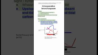 Intraoperative bronchospasm [upl. by Arec]