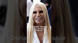 Donatella Versace Now VS Without Surgeries 90s donatellaversace versace shortsfeed runway [upl. by Anitsua641]