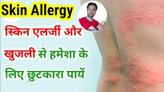 skin par lal lal kyo nikal raha hai  skin allergy  skin rashes kya  skin allergy kaise thik kare [upl. by Deck]