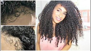 UNBELIEVABLE Rice water Challenge results I grew back my edges yall [upl. by Nosro]