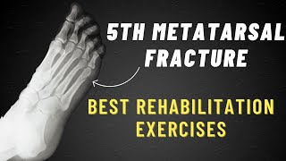 5th Metatarsal Fracture Exercises  6 Week Program [upl. by Nylzor]