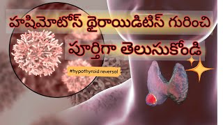 All about Hashimotos Thyroiditis in Telugu  How to cure  Diet Changes  Dr Harika Kuppala [upl. by Ahsoik]