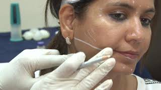 Complete video training on Botulinum Injections for face and Neck [upl. by Nylhtak180]