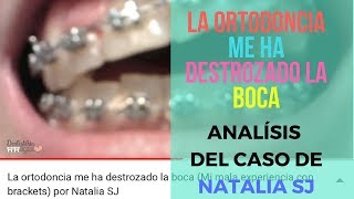 LA ORTODONCIA ME HA DESTROZADO LA BOCA  ANÁLISIS DEL CASO DE NATALIA SJ [upl. by Esra]