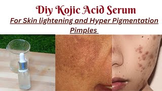 Diy Kojic Acid SerumHomemade Kojic Acid Serum makingKojic Acid Serum [upl. by Eceirehs]