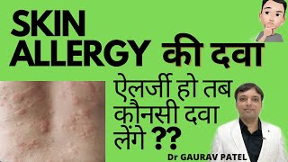 Skin allergy treatment  स्किन ऐलर्जी की दवाई skin allergy ki dawa Allergy ka ilaj at home [upl. by Ahsemo227]