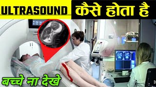 Ultrasound Kaise Hota Hai  Ultrasound Scan [upl. by Eltsyrc]