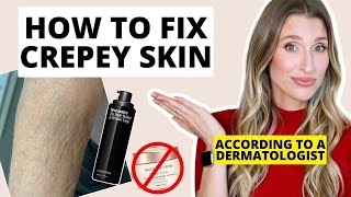 How to Fix Crepey Skin  Dermatologist Explains How to Firm Body Skin [upl. by Chelsey]