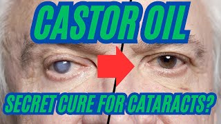 Castor Oil Secret Cure for Cataracts in 2024 [upl. by Kannry690]