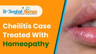 What is Cheilitis  and Homeopathic Treatment for Cheilitis  Dr Singhal Homeo Chandigarh [upl. by Cramer741]