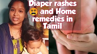 Diaper rashes and Home remedies in Tamil  Types of diaper rashes  How to prevent [upl. by Weatherby]