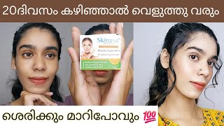 30 Days വെല്ലുവിളി permanent skin whitening and remove pimplesഓരോദിവസവും വെളുക്കുന്നത് കാണാം😱 [upl. by Ayifas]