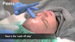 How to treat melasma pigmentation [upl. by Eeral]