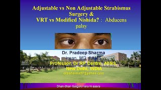 Adjustable surgery and Vertical Rectus Transposition in Cybersight Webinar [upl. by Oberheim]