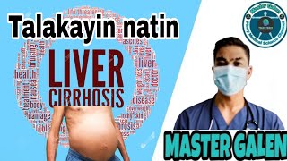 Liver Cirrhosis talakayin natin [upl. by Wilonah]