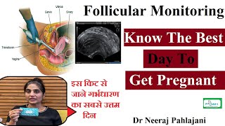 Follicular Study in Hindi  Dr Neeraj Pahaljani [upl. by Trebla511]