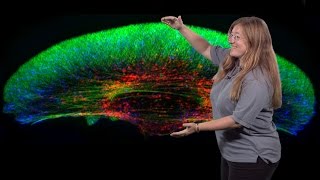 Julie Theriot Stanford HHMI 2 Mechanics and Dynamics of Rapid Cell Motility [upl. by Johannes976]