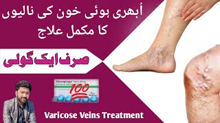 What is varicose veins Varicose veins treatment In urdu  ubhari hui naso ka ilaj [upl. by Champaigne]