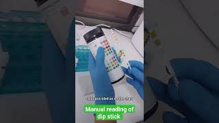 How to read urine dip stick laboratory urinalysis dipstick [upl. by Enitsuga]