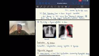 BRONCHIAL ASTHMA For University Studentsl Dr Sahil Bansal [upl. by Aikrahs]