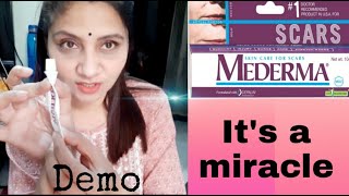 Mederma Cream Review amp Demo  Best Cream for Scars  Womens World [upl. by Jonie]